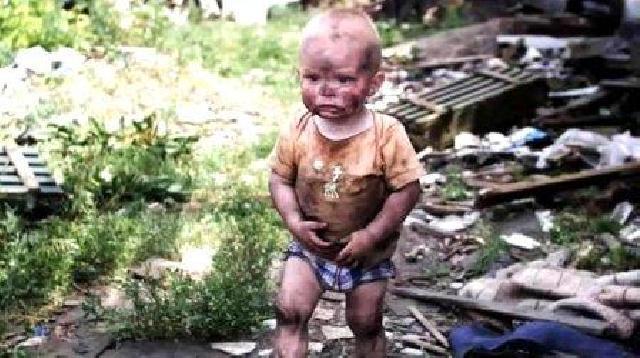 Rusiyanın işğalı nəticəsində Ukraynada 262 uşaq ölüb,467-dən çox uşaq yaralanıb